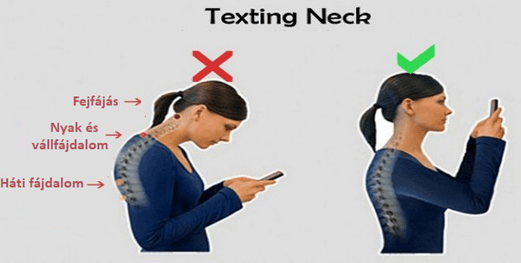 text neck
